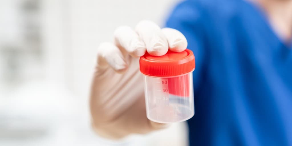 Szczawiany wapnia w moczu