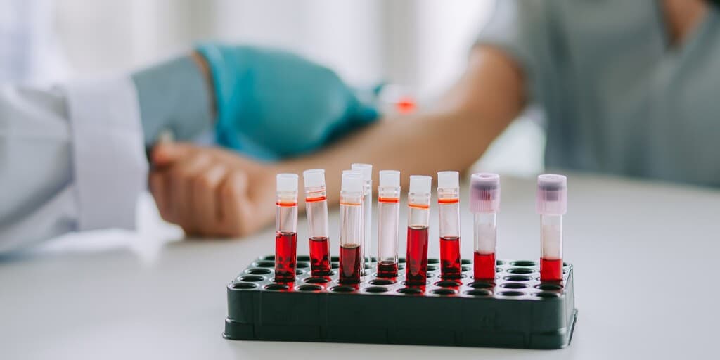 Markery nowotworowe żołądka