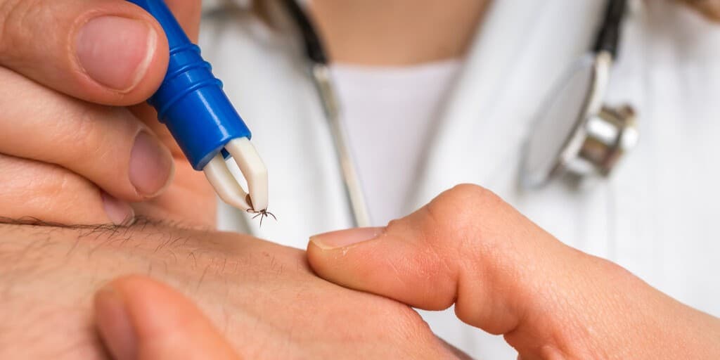 Choroby przenoszone przez kleszcze